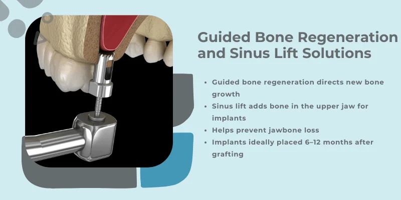 Guided bone regeneration and sinus lift solutions