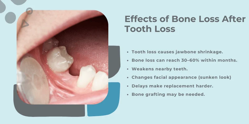 Effects of bone loss after tooth loss