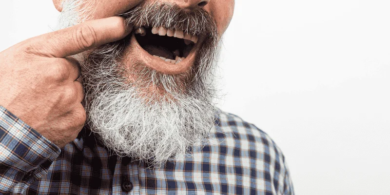 Effects of missing a single tooth