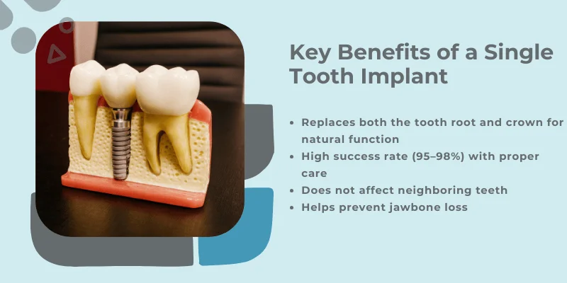 Key benefits of single tooth implant
