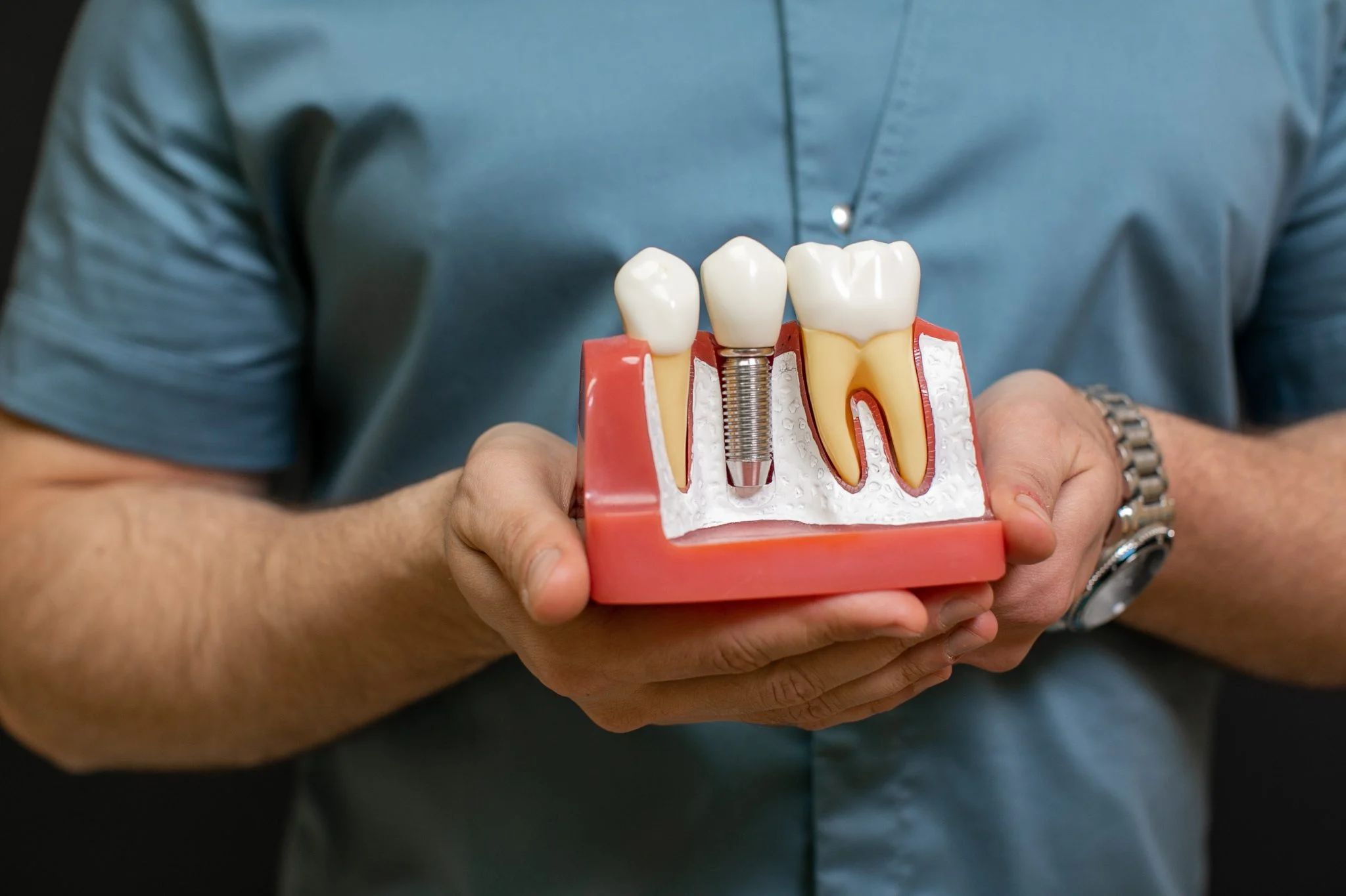 Complete Tooth Replacement Solutions for Your Upper or Lower Jaw