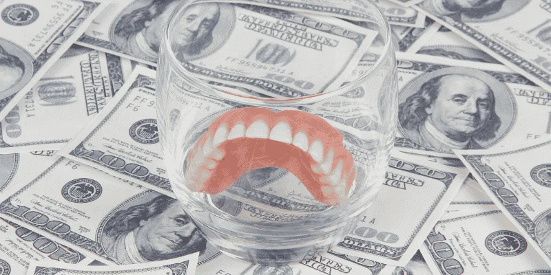 Dental implant payment plans explained