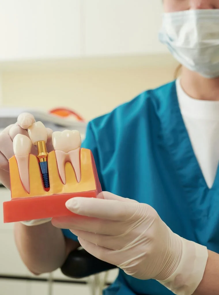 who-are-implant-supported-overdentures